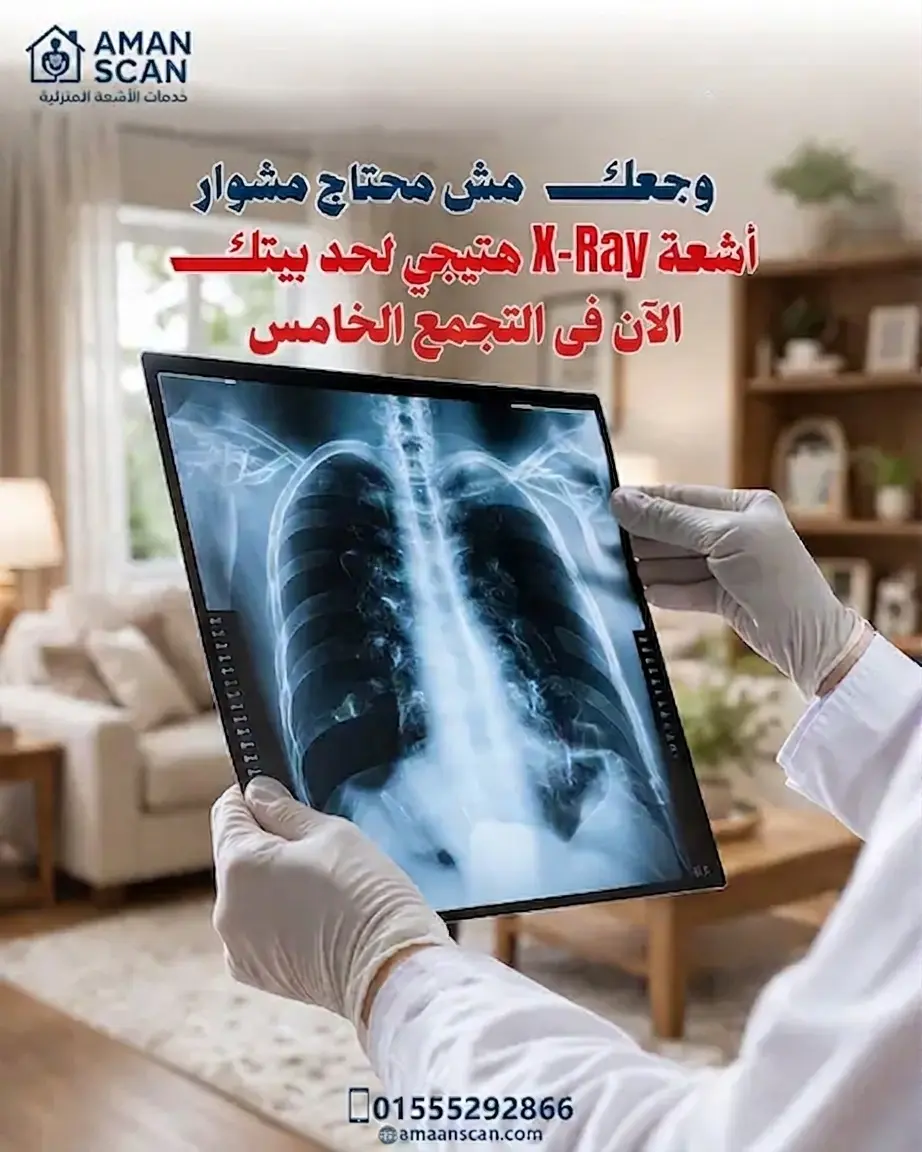 اشعة-اكس-راى-منزلية-في-التجمع-الخامس