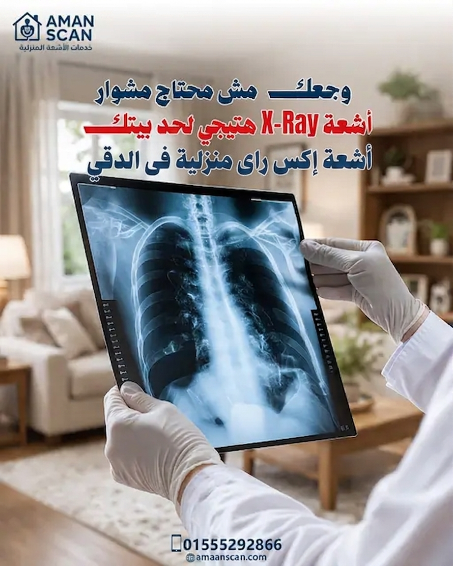 اشعة-اكس-راى-منزلية-في-الدقي