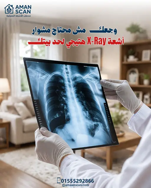 اشعة-اكس-راى-منزلية-في-المعادي