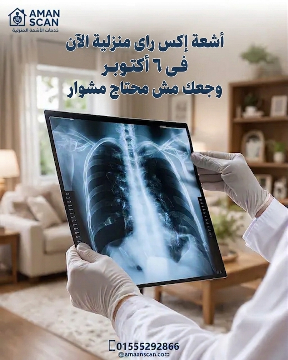 اشعة-اكس-راى-منزلية-في-٦-اكتوبر
